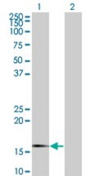 Monoclonal Anti-SNCG, (C-terminal) antibody produced