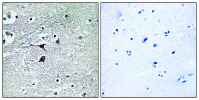 Anti-Tryptophan Hydroxylase antibody produced in