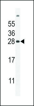 ANTI-FAT10(C-TERMINAL) antibody produced in rabbit