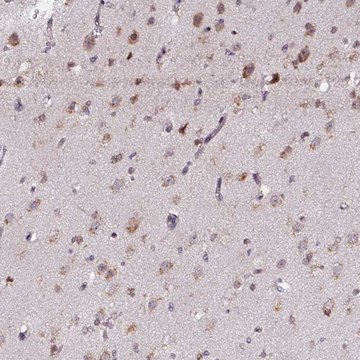 Anti-APOLD1 antibody produced in rabbit