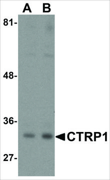 Anti-CTRP1 (ab1) antibody produced in