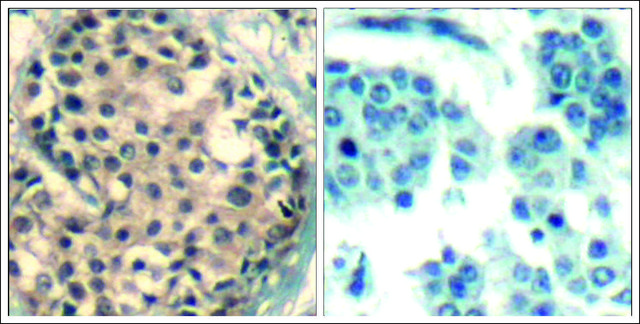 Anti-phospho-HDAC9/HDAC4/HDAC5 (pSer²??/pSer²??/pSer²²?) antibody produced in