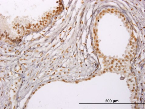 ANTI-RUNX1 antibody produced in mouse
