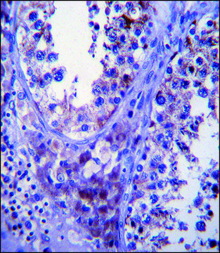 ANTI-SDF2L1 (C-TERM) antibody produced in
