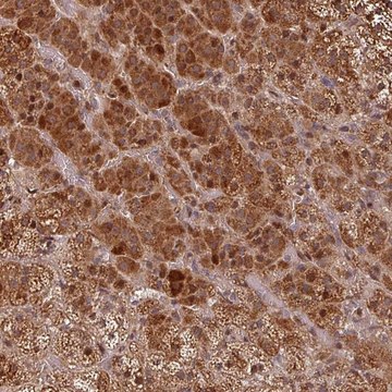 Anti-EID1 antibody produced in rabbit