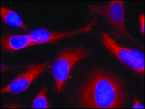 Anti-phospho-PRKD1 (pSer?³?) antibody produced in