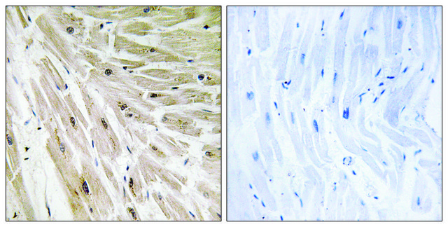 Anti-RPL22 antibody produced in rabbit