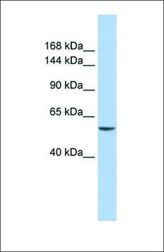 Anti-CHD2 antibody produced in rabbit