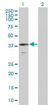 Anti-BDH1 antibody produced in rabbit