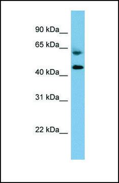 Anti-RMND1 antibody produced in rabbit