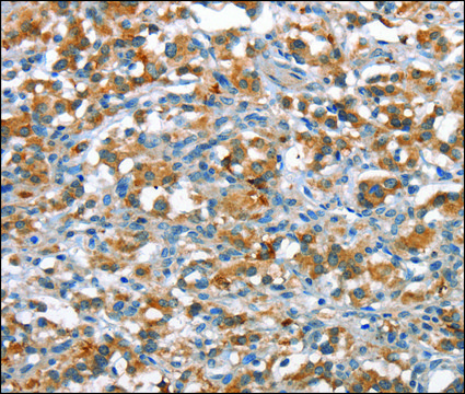 Anti-ANP32C antibody produced in rabbit