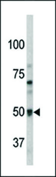 ANTI-PAEL-R (GPR37)(N-TERMINAL) antibody produced in