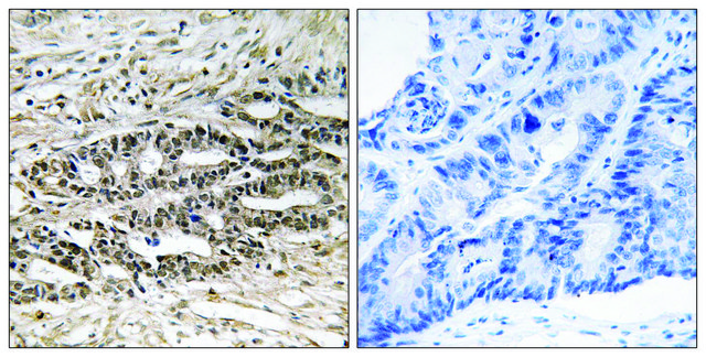 Anti-MDM4 antibody produced in rabbit