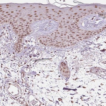 Anti-THOC6 antibody produced in rabbit