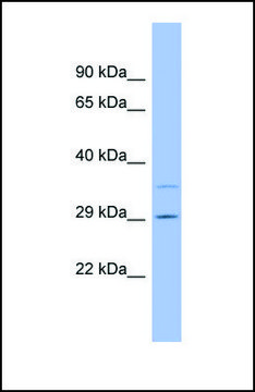 Anti-F12, (N-terminal) antibody produced in
