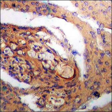 Anti-phospho-Bax (pSer¹??) antibody produced in