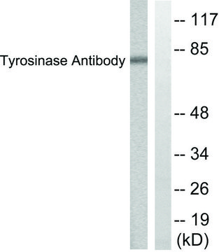 Anti-Tyrosinase antibody produced in rabbit