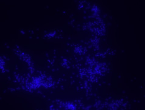 Porphyromonas gingivalis FISH probe -