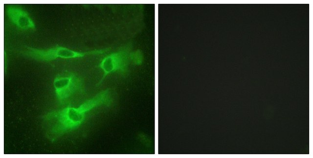 Anti-TNR4 antibody produced in rabbit