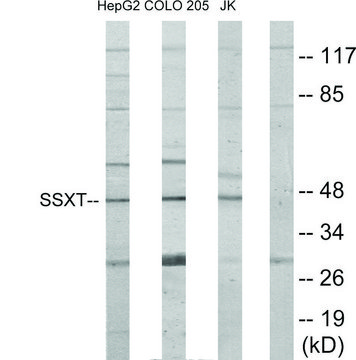 Anti-SSXT, N-Terminal antibody produced in