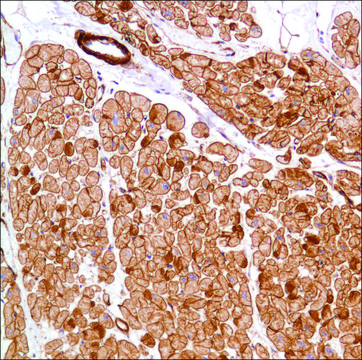 Anti-Vinculin antibody, Rabbit monoclonal