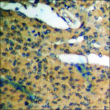 Anti-phospho-Cyclin D1 (pThr²??) antibody produced
