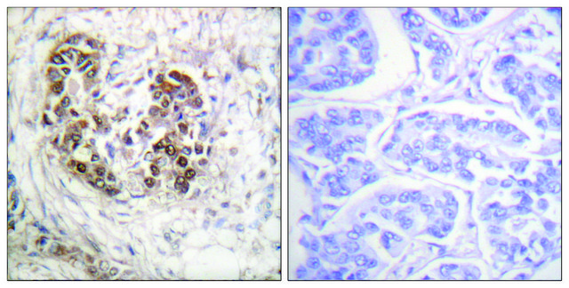 Anti-p53 antibody produced in rabbit