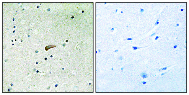 Anti-phospho-FRS2 (pTyr?³?) antibody produced in