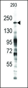Anti-Mouse Jmjd3 (center) antibody produced