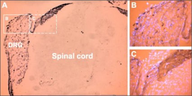 Anti-Purinergic Receptor P2X? antibody produced