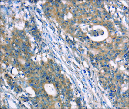 Anti-NDNL2 antibody produced in rabbit