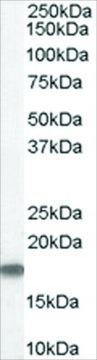 Anti-STMN1/STATHMIN 1 antibody produced in