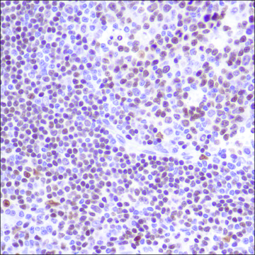 Anti-PU.1 antibody, Rabbit monoclonal