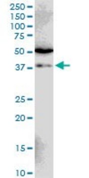 Monoclonal Anti-SIAH1, (N-terminal) antibody produced