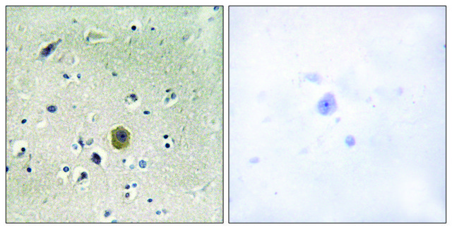Anti-MEK1 antibody produced in rabbit