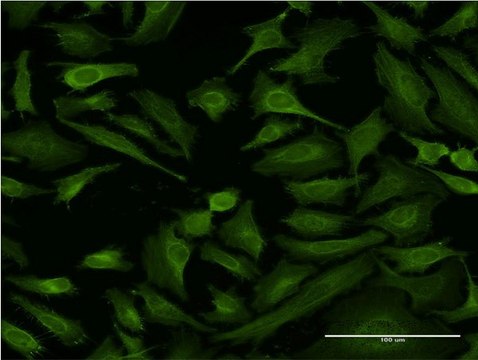 Monoclonal Anti-ABTB1 antibody produced in