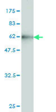 Monoclonal Anti-CBR1 antibody produced in