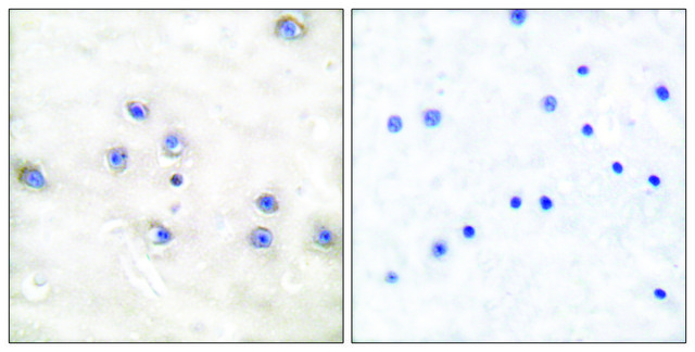 Anti-COT antibody produced in rabbit