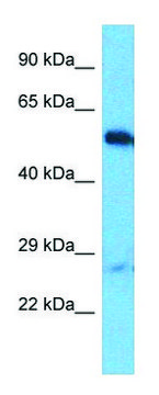 Anti-OTUD1 (C-terminal) antibody produced in