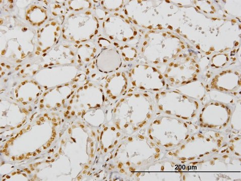 Monoclonal Anti-NCOA4, (C-terminal) antibody produced
