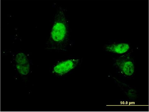 ANTI-SURB7 antibody produced in mouse
