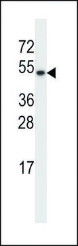 ANTI-TXNDC15(C-TERMINAL) antibody produced in rabbit
