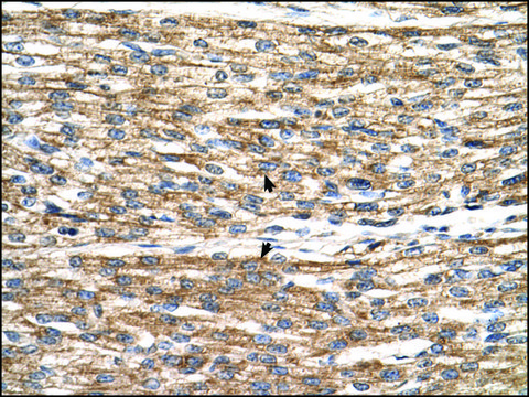 Anti-PNPLA3 antibody produced in rabbit