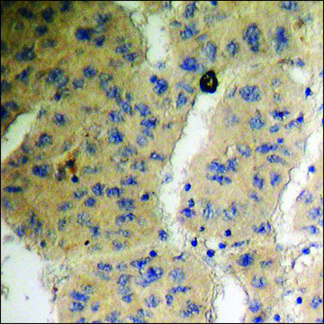 Anti-phospho-MSK1 (pSer³??) antibody produced in
