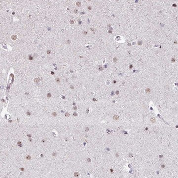 Anti-UTP18 antibody produced in rabbit