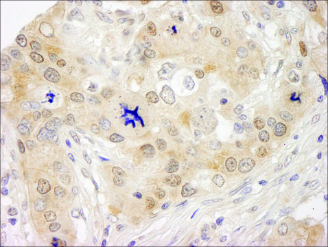 Rabbit anti-Lasu1/Ureb1 Antibody, Affinity Purified