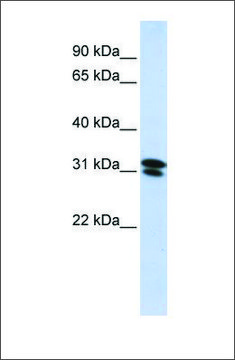 Anti-RNF182 (ab1) antibody produced in
