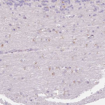 Anti-FOCAD antibody produced in rabbit