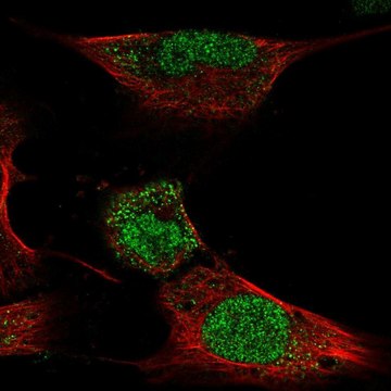 Anti-HOXC4 antibody produced in rabbit