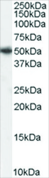 Anti-PICK1 antibody produced in goat